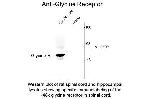 Western Blot of Anti-Glycine Receptor (Rabbit) Antibody - 600-401-D65 Western Blot of Rabbit anti-Glycine Receptor antibody.