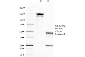 SDS-PAGE Analysis Purified Spectrin beta III Monoclonal Antibody (SPTBN2/1583) labeled with CF488 (Green).
