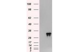 HEK293T cells were transfected with the pCMV6-ENTRY control (Left lane) or pCMV6-ENTRY Noggin (RC205020) (Right lane) cDNA for 48 hrs and lysed. (NOG anticorps  (AA 28-232))