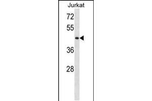 Western blot analysis in Jurkat cell line lysates (35ug/lane). (STK33 anticorps  (N-Term))