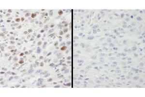 Immunohistochemistry (IHC) image for anti-Minichromosome Maintenance Complex Component 2 (MCM2) (pSer40), (pSer41) antibody (ABIN7448650) (MCM2 anticorps  (pSer40, pSer41))