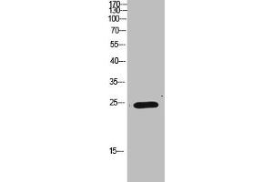 Western Blot analysis of HEPG2 cells using Antibody diluted at 1000. (IMP3 anticorps  (AA 135-184))