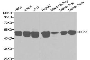 Western blot analysis of extracts of various cell lines, using SGK1 antibody (ABIN5970402) at 1/1000 dilution. (SGK1 anticorps)