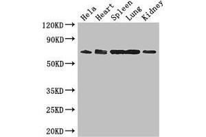 Western Blot Positive WB detected in: Hela whole cell lysate, Mouse heart tissue, Mouse spleen tissue, Mouse lung tissue, Mouse kidney tissue All lanes: ENTPD7 antibody at 2. (ENTPD7 anticorps  (AA 51-350))