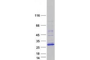 Validation with Western Blot