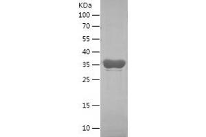 Western Blotting (WB) image for Insulin-Like Growth Factor 2 mRNA Binding Protein 3 (IGF2BP3) (AA 284-579) protein (His tag) (ABIN7123456)