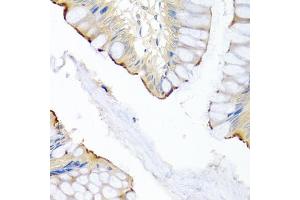 Immunohistochemistry of paraffin-embedded human colon using LRG1 antibody (ABIN5975207) at dilution of 1/100 (40x lens). (LRG1 anticorps)