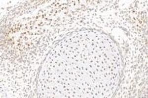 Immunohistochemistry analysis of paraffin-embedded rat fetal rat using,GDF6 (ABIN7074132) at dilution of 1: 1000