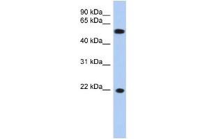 WB Suggested Anti-CRYGC Antibody Titration: 0. (CRYGC anticorps  (Middle Region))