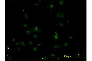 Immunofluorescence of monoclonal antibody to BARX1 on HeLa cell.