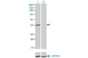Western blot analysis of ADH4 over-expressed 293 cell line, cotransfected with ADH4 Validated Chimera RNAi (Lane 2) or non-transfected control (Lane 1). (ADH4 anticorps  (AA 52-150))