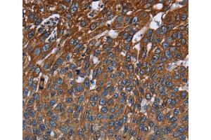 Immunohistochemistry (IHC) image for anti-Fc Fragment of IgG, Low Affinity IIIa, Receptor (CD16a) (FCGR3A) antibody (ABIN2423641) (FCGR3A anticorps)