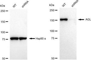 Western blotting analysis using AGL antibody (ABIN7797592).