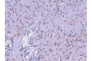 Detection of HSPA1A in Human Prostate Tissue using Monoclonal Antibody to Heat Shock 70 kDa Protein 1A (HSPA1A)