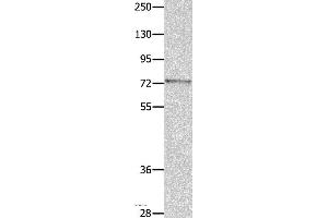 Western blot analysis of Mouse eye tissue, using MUC20 Polyclonal Antibody at dilution of 1:1400