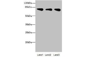 Western blot All lanes: ACSS2antibody at 2. (ACSS2 anticorps  (AA 462-701))