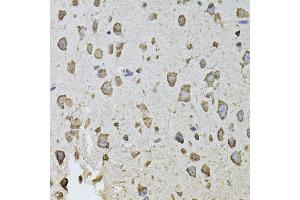Immunohistochemistry of paraffin-embedded mouse brain using FGF2 antibody (ABIN1872685) at dilution of 1:100 (40x lens). (FGF2 anticorps)