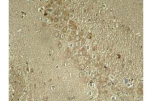 Immunohistochemical staining of rat hippocampal region tissue from a model with Alzheimer using MAPT (phospho S262) polyclonal antibody  under 1:50-1:100 dilution.