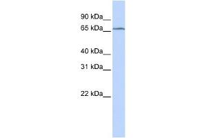 TRMT5 antibody used at 1 ug/ml to detect target protein. (TRMT5 anticorps)