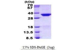 Figure annotation denotes ug of protein loaded and % gel used. (SRSF1 Protéine)