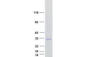 Validation with Western Blot (TMEM176A Protein (Myc-DYKDDDDK Tag))
