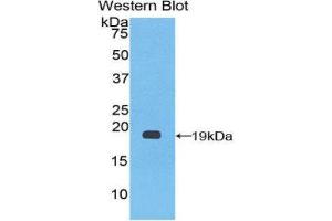 Western Blotting (WB) image for anti-Coagulation Factor VIII (F8) (AA 1887-2044) antibody (ABIN1858766) (Factor VIII anticorps  (AA 1887-2044))