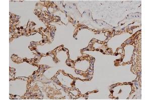 ABIN6267521 at 1/200 staining Rat lung tissue sections by IHC-P.