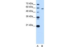 PKLR antibody - N-terminal region  validated by WB using HepG2 cell lysate at 1. (PKLR anticorps  (N-Term))