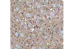 IHC analysis of ABI2 using anti-ABI2 antibody (ABIN7600125).