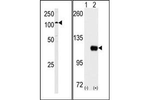 Image no. 2 for anti-Hexokinase 1 (HK1) (C-Term) antibody (ABIN360645) (Hexokinase 1 anticorps  (C-Term))