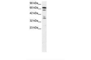 Image no. 1 for anti-Zinc Finger Protein 512 (ZNF512) (AA 205-254) antibody (ABIN6735835) (ZNF512 anticorps  (AA 205-254))
