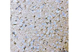 IHC analysis of Septin 2/SEPTIN2 using anti-Septin 2/SEPTIN2 antibody (ABIN7599275). (Septin 2 anticorps  (AA 1-326))