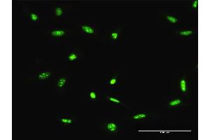Immunofluorescence of purified MaxPab antibody to ADAR on HeLa cell.