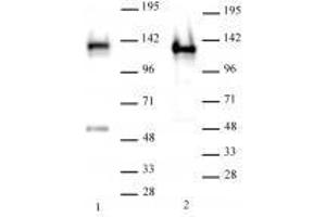 SMARCA1 / SNF2L1 antibody (rAb) tested by Western blot.