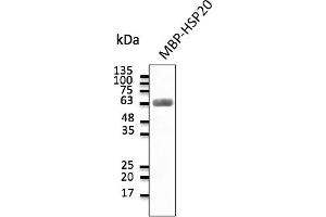 Western Blotting (WB) image for anti-Heat Shock Protein, alpha-Crystallin-Related, B6 (HSPB6) antibody (ABIN7273045) (HSPB6 anticorps)