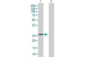 Lane 1: CDKN1B transfected lysate ( 22 KDa) Lane 2: Non-transfected lysate.