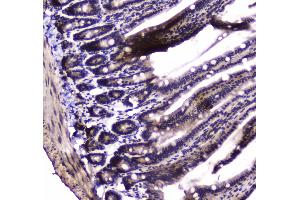 IHC analysis of PARN using anti-PARN antibody . (PARN anticorps  (AA 1-301))