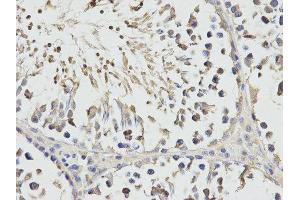Immunohistochemistry (IHC) image for anti-Ribosomal Protein S3 (RPS3) antibody (ABIN1874658) (RPS3 anticorps)