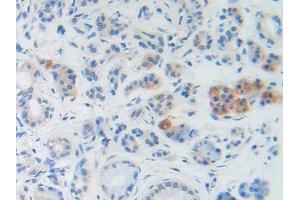 DAB staining on IHC-P; Samples: Human Stomach Tissue (BNP anticorps  (AA 27-134))