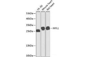 Western blot analysis of extracts of various cell lines using MYL1 Polyclonal Antibody at dilution of 1:1000. (MYL1 anticorps)