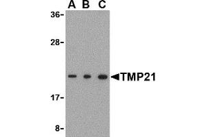 Western Blotting (WB) image for anti-Transmembrane Emp24-Like Trafficking Protein 10 (TMED10) (C-Term) antibody (ABIN1030758) (TMED10 anticorps  (C-Term))