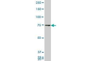 HNRPM monoclonal antibody (M01), clone 2B6.