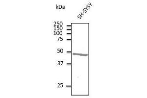 Anti-ATXN3 Ab at 1/500 dilution, lysates at 100 µg per Iane, rabbit polyclonal to goat lgG (HRP) at 1/10,000 dilution, (Ataxin 3 anticorps  (AA 120-250))