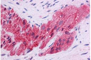 Human Colon, Myenteric Plexus: Formalin-Fixed, Paraffin-Embedded (FFPE)