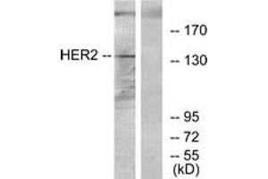 Western blot analysis of extracts from 293 cells, using HER2 Antibody. (ErbB2/Her2 anticorps  (AA 641-690))
