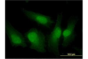 Immunofluorescence of monoclonal antibody to IRF3 on HeLa cell.