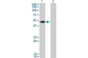 Western Blot analysis of ANGPTL5 expression in transfected 293T cell line by ANGPTL5 monoclonal antibody (M01), clone 1B2. (ANGPTL5 anticorps  (AA 1-388))