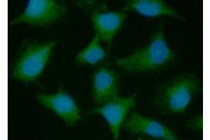 ICC/IF analysis of PSMD10 in A549 cells line, stained with DAPI (Blue) for nucleus staining and monoclonal anti-human PSMD10 antibody (1:100) with goat anti-mouse IgG-Alexa fluor 488 conjugate (Green).