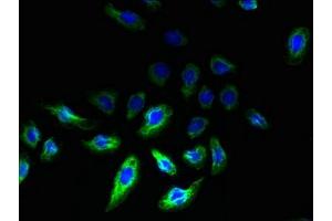 anti-Receptor Accessory Protein 2 (REEP2) (AA 78-252) antibody