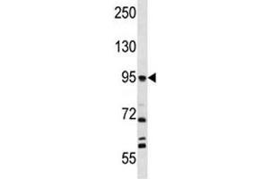 FAP antibody western blot analysis in NCI-H292 lysate.